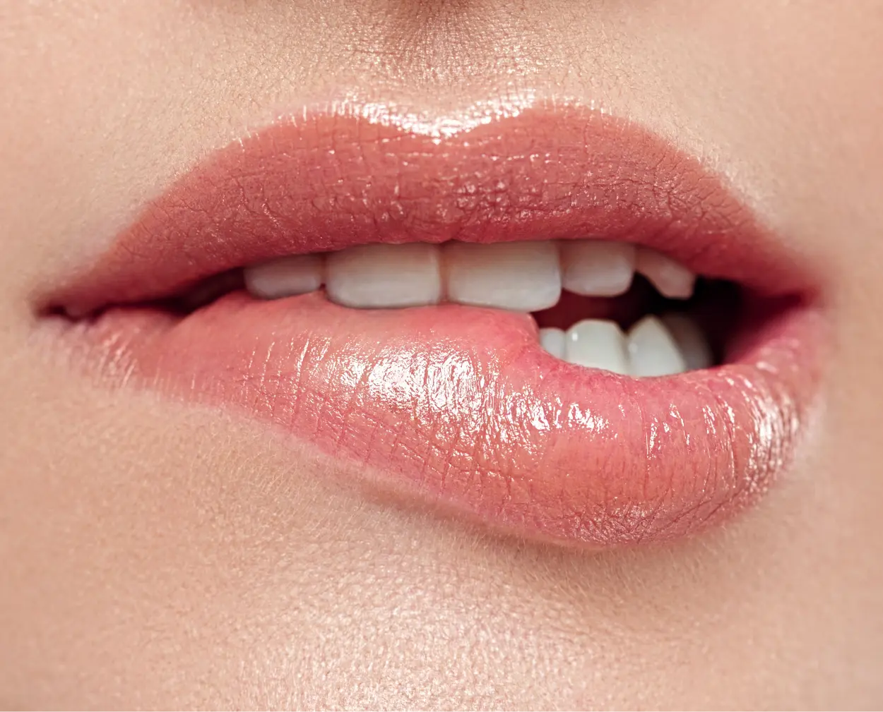Read more about the article Lip Filler vs. Botox: What&rsquo;s the Difference?