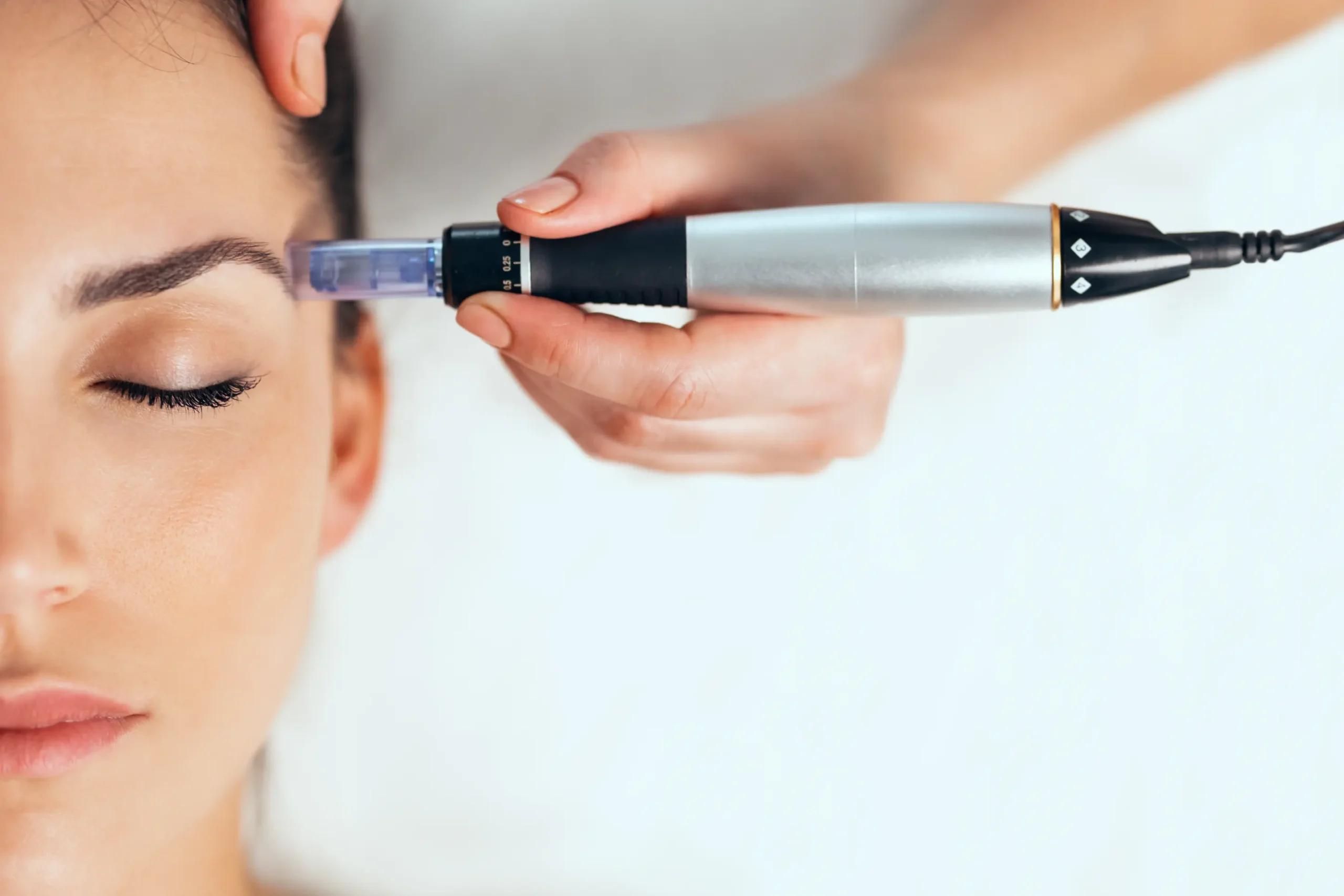 Read more about the article Morpheus8 vs. Microneedling: Which Is Right for You?