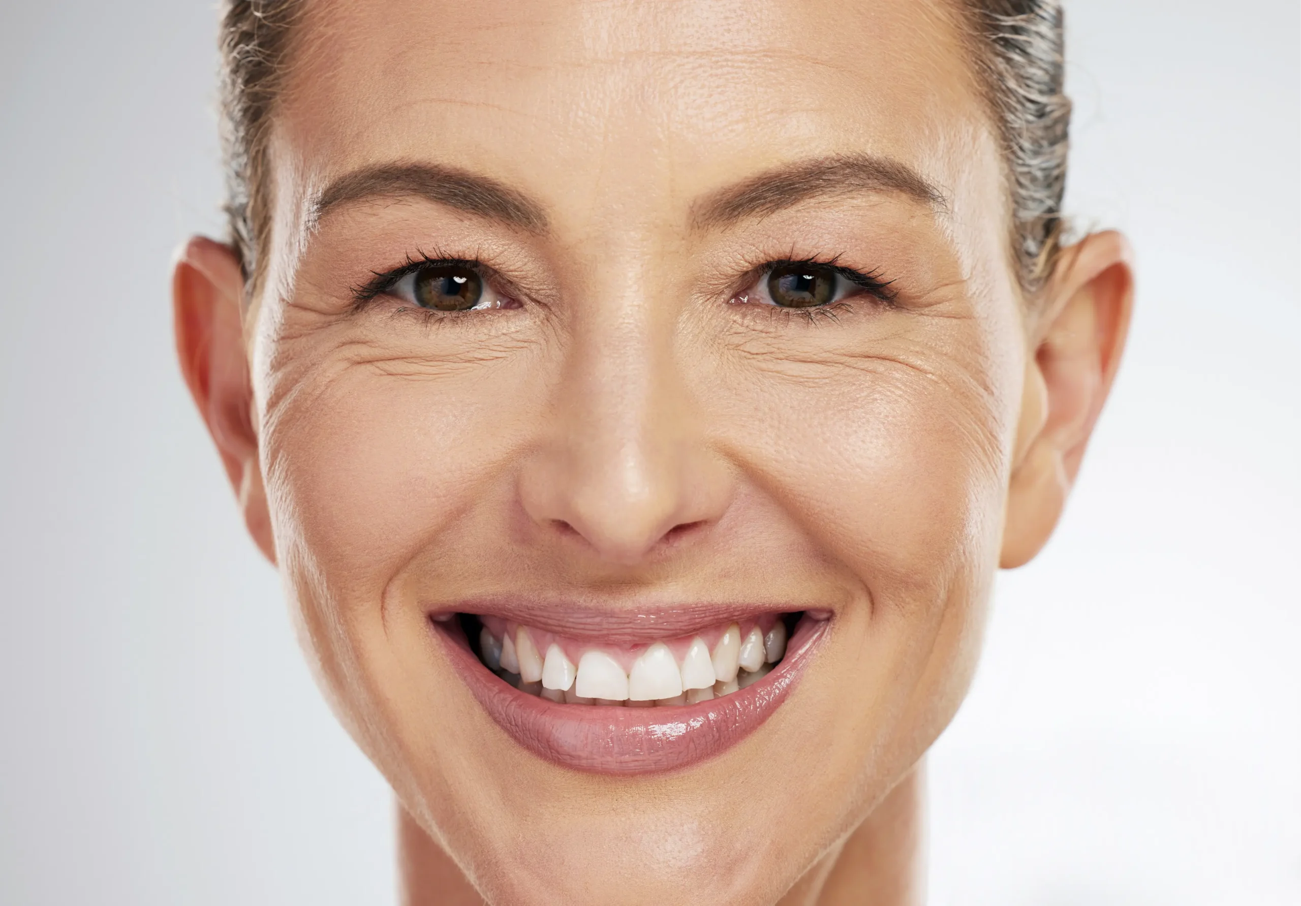 Read more about the article Preventative Botox: When Should You Start?